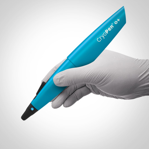 Cryopen Treatments
